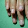 Восстановление ногтей после наращивания Как лечить ногти после наращивания гелем