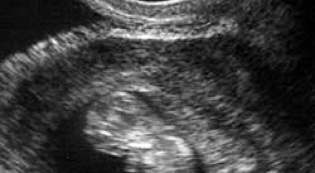 ორსულობის მეშვიდე კვირა - რა ხდება?